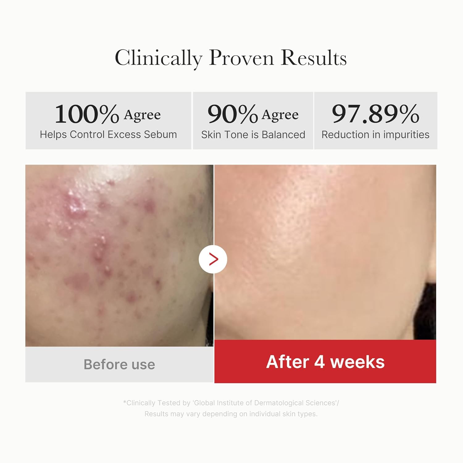 [Medicube] Discos exfoliantes de ácido succínico Red 70 unidades
